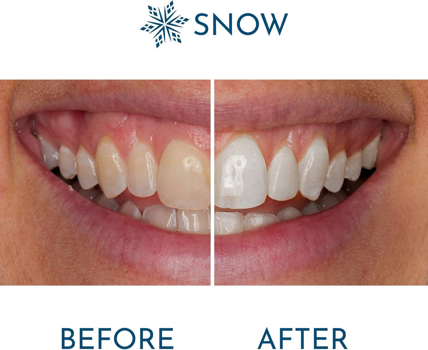 Snow Extra-Strength Teeth Whitening Pen